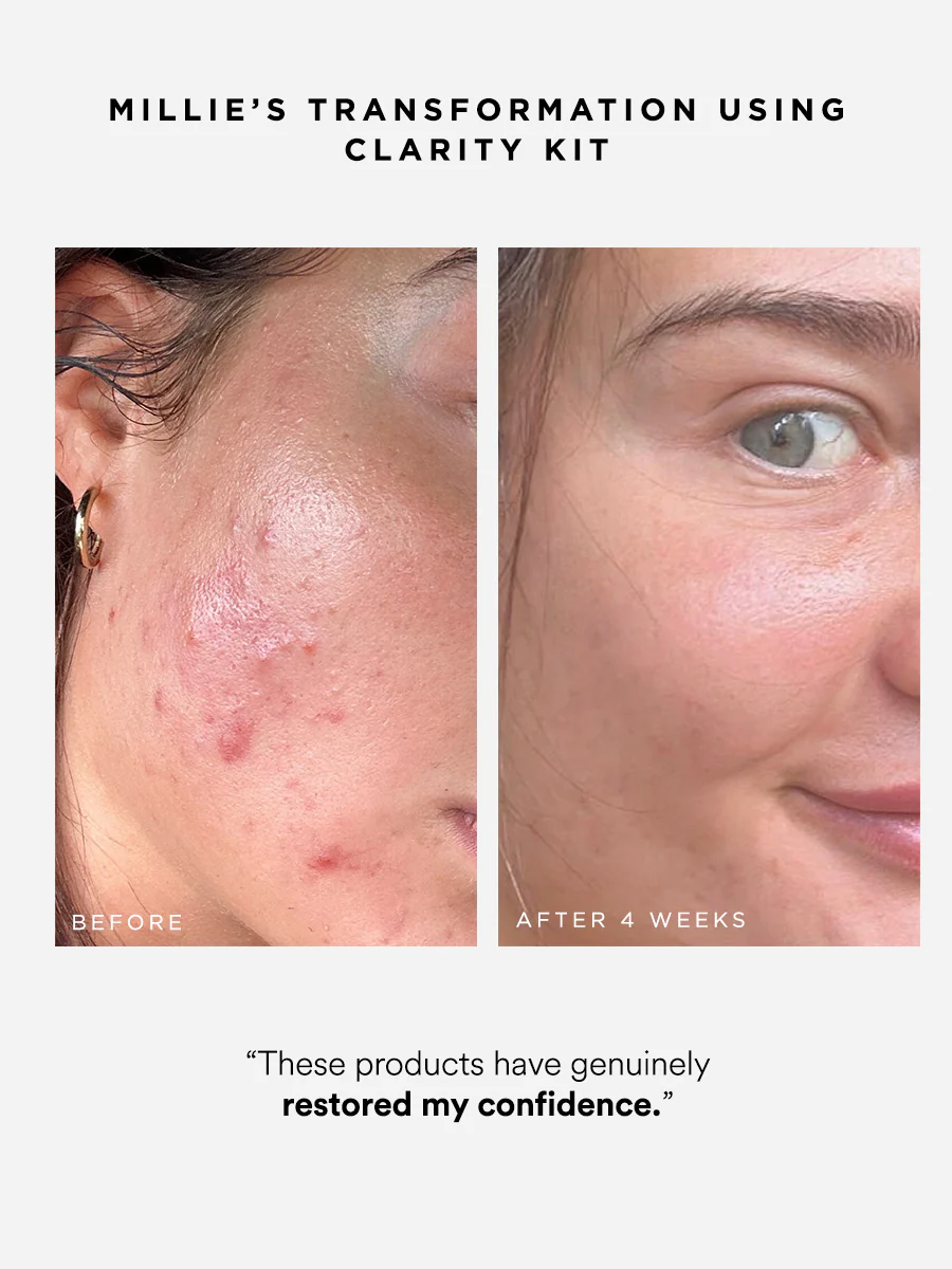 Clarity Kit - Image 3