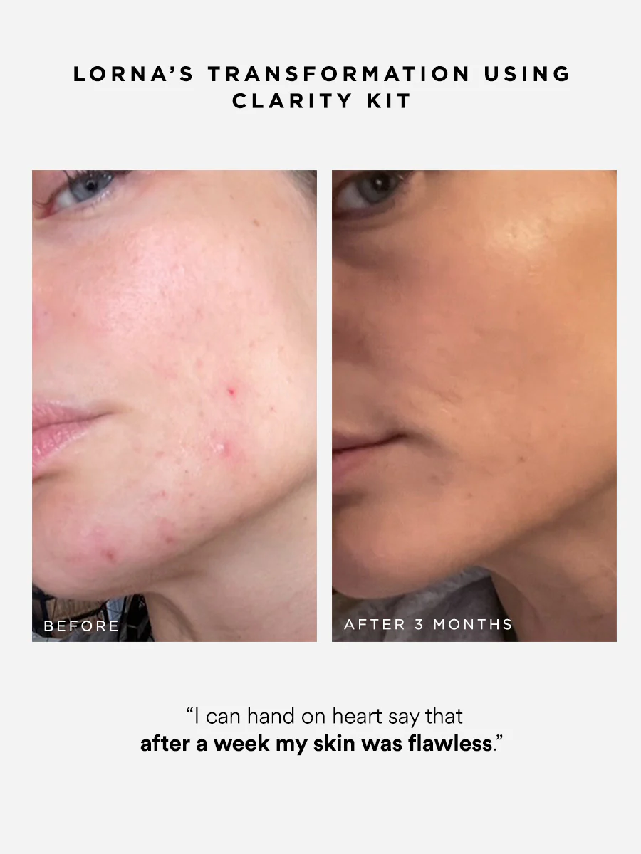 Clarity Kit - Image 4