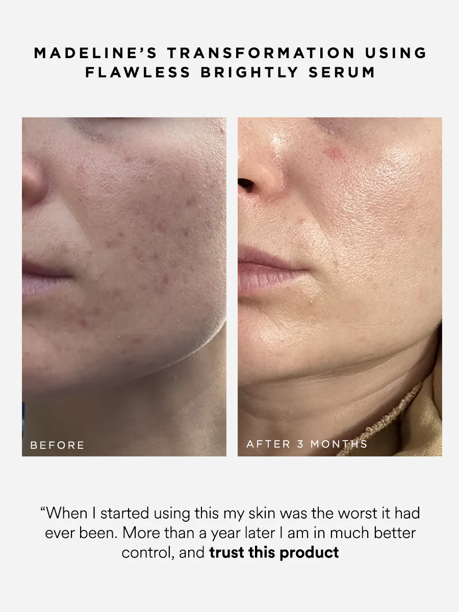 Flawless Brightly 10% Azelaic Acid Serum - Image 4