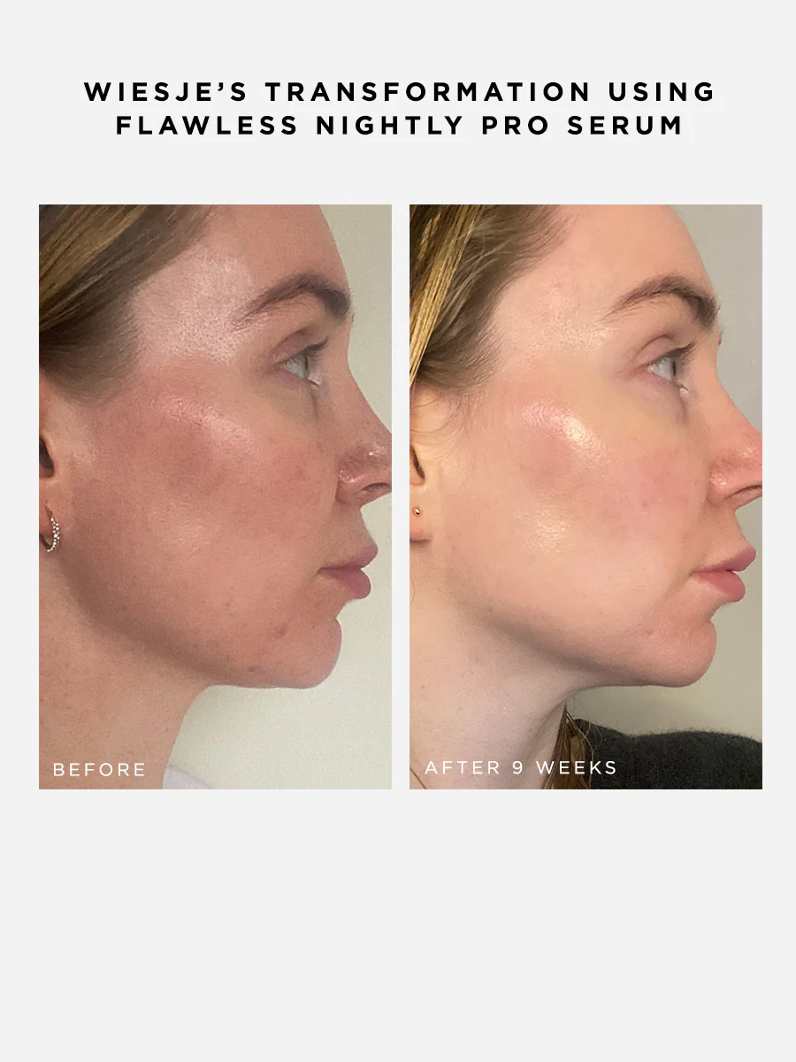 Flawless Nightly Pro 5% Retinoid Serum - Image 3