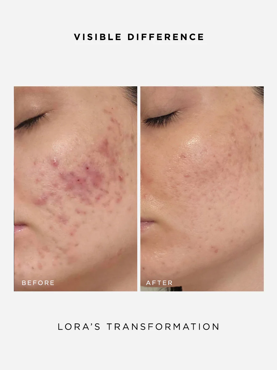 Skin Confidence Set - Image 3