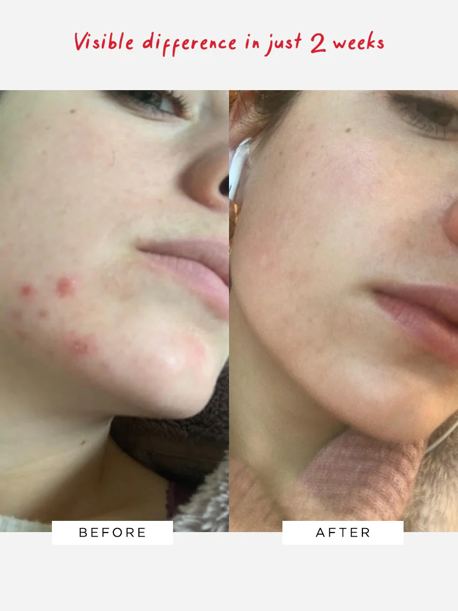 The Clarity Pro Duo - Image 3